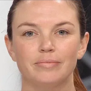 The Secret Of Age Reduction--SATVEE™ Lids Lift