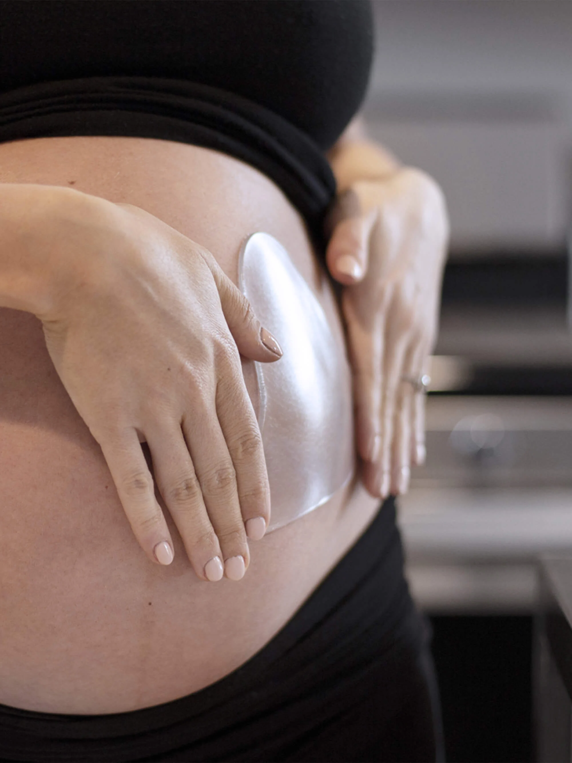 Enhanced SILICONEFUSION™ Stretch Mark Kit