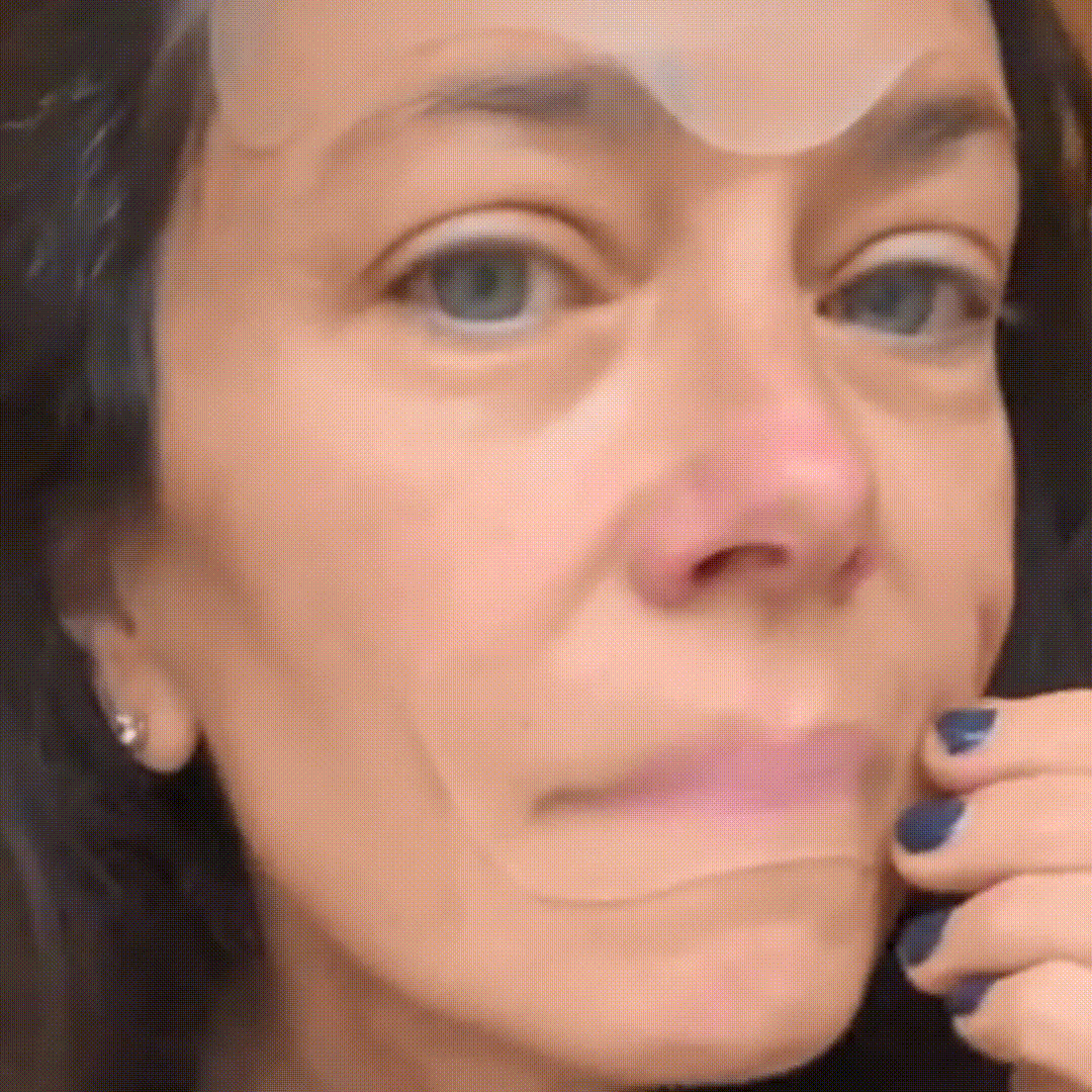 🔥Buy 1 Get 1 Free😍Magical Wrinkle Patches