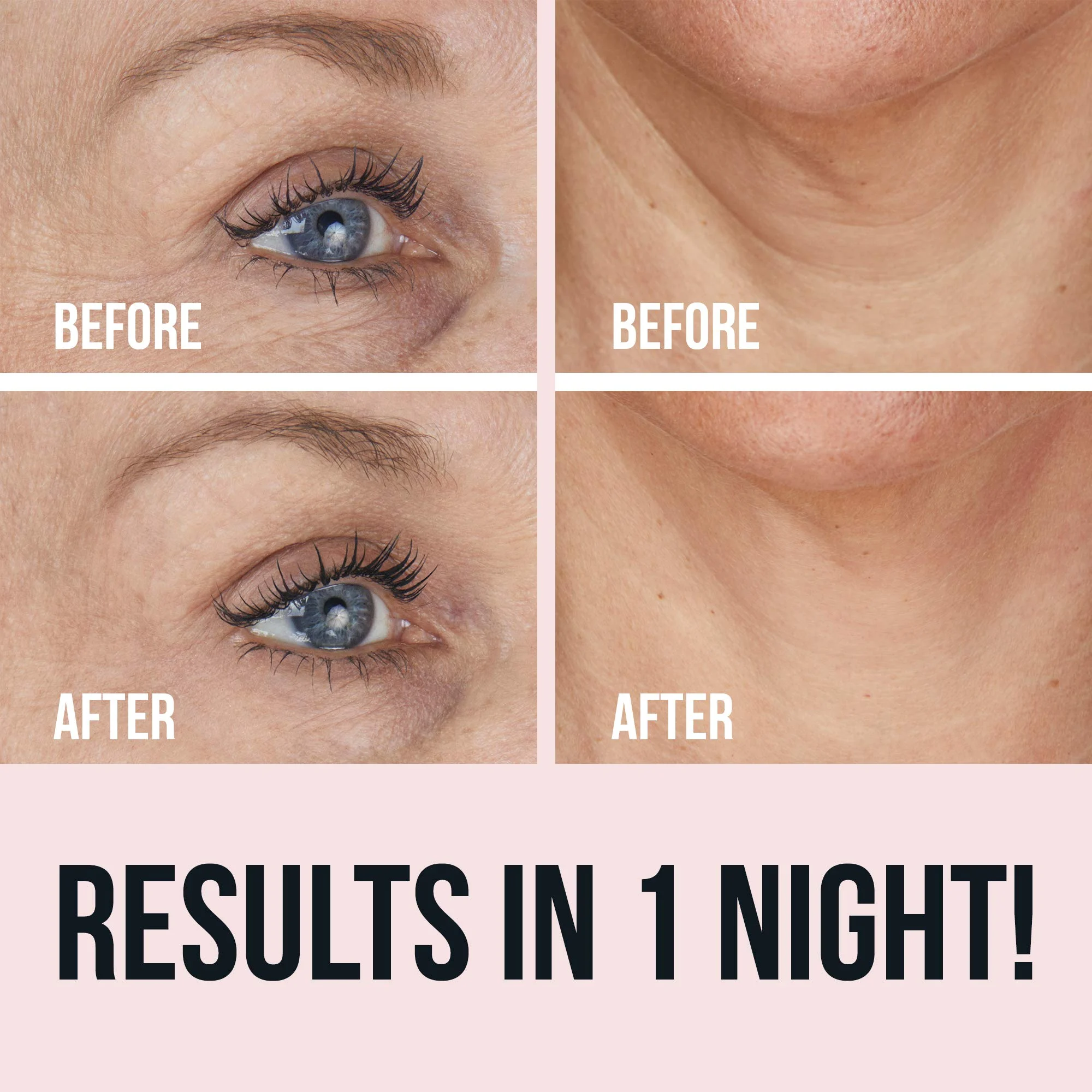 🔥Buy 1 Get 1 Free😍Magical Wrinkle Patches